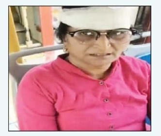 बसला दरवाजा नसल्याने दोन महिला प्रवासी पडून जखमी